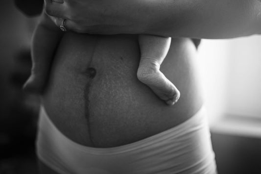 Pelvic Floor Therapy: Listening to Your Body to Choose the Right Method - Élhée